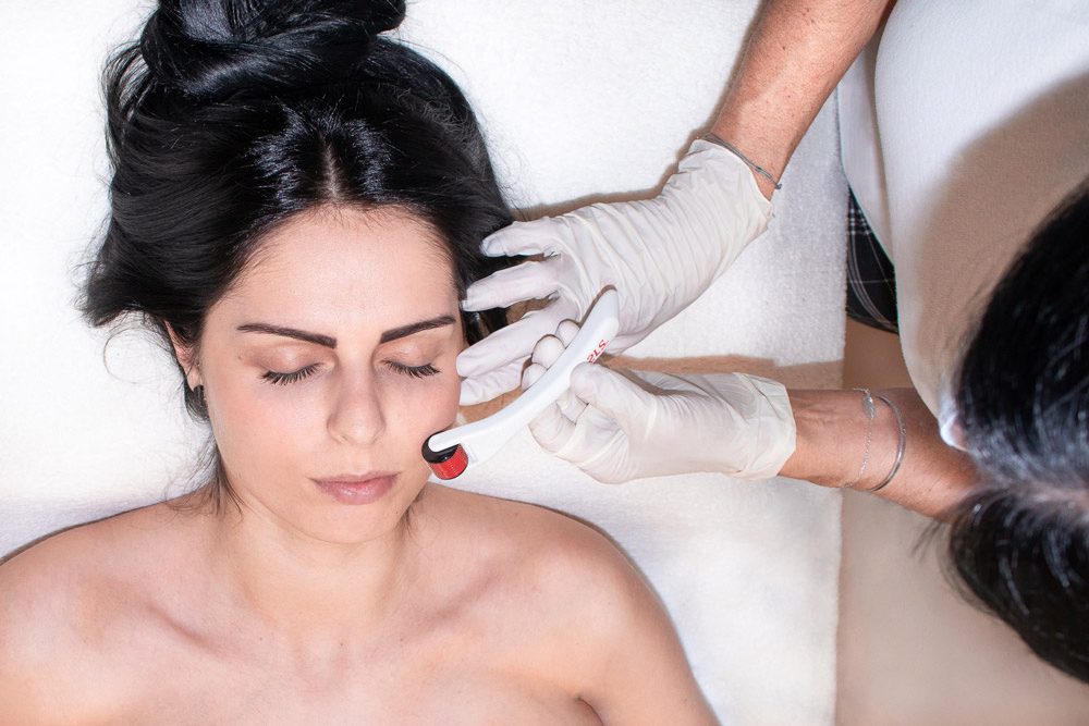 Microneedling für Damen - KörperBewusstsein microneedling_frau-koerper_bewusstsein