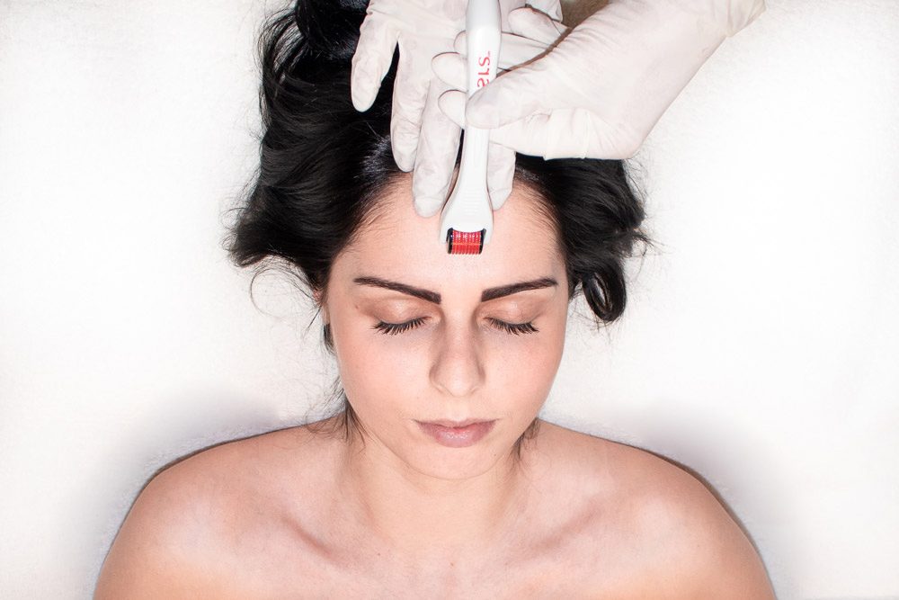 Schönheit von innen und außen - KörperBewusstsein microneedling_frau-koerper_bewusstsein
